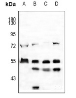 EGR Rabbit Polyclonal Antibody