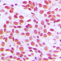 EGR Rabbit Polyclonal Antibody