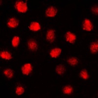EGR Rabbit Polyclonal Antibody