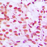 ELK1 (Phospho-S389) Rabbit Polyclonal Antibody