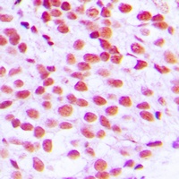 ELK1 Rabbit Polyclonal Antibody