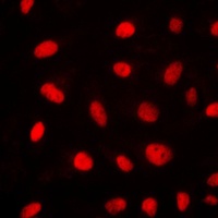 ELK1 Rabbit Polyclonal Antibody