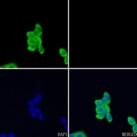 EPHA3 Rabbit Polyclonal Antibody