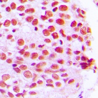 PE2 Rabbit Polyclonal Antibody