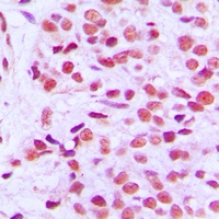 ETS1 (Phospho-T38) Rabbit Polyclonal Antibody