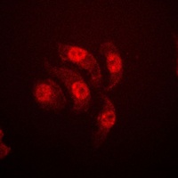 ETS1 (Phospho-T38) Rabbit Polyclonal Antibody