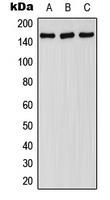 FANCA (Phospho-S1149) Rabbit Polyclonal Antibody