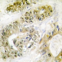 FANCA (Phospho-S1149) Rabbit Polyclonal Antibody