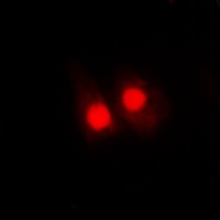 FANCA (Phospho-S1149) Rabbit Polyclonal Antibody