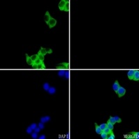 FASN Rabbit Polyclonal Antibody