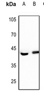 FEN1 Rabbit Polyclonal Antibody