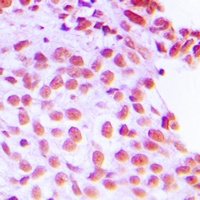 FEN1 Rabbit Polyclonal Antibody