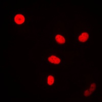 FEN1 Rabbit Polyclonal Antibody