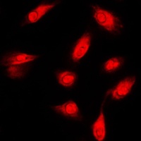 c-FER Rabbit Polyclonal Antibody