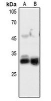 FGF5 Rabbit Polyclonal Antibody