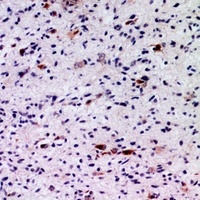 FGF5 Rabbit Polyclonal Antibody