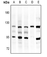 FGFR3 Rabbit Polyclonal Antibody