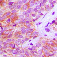 FGFR3 Rabbit Polyclonal Antibody