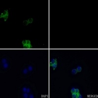 FGFR3 Rabbit Polyclonal Antibody