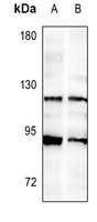 FGFR2 Rabbit Polyclonal Antibody