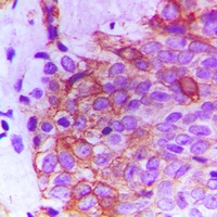 FGFR2 Rabbit Polyclonal Antibody