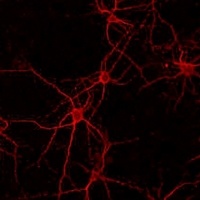 FGFR2 Rabbit Polyclonal Antibody