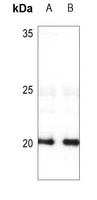 FHIT Rabbit Polyclonal Antibody