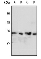 FHL2 Rabbit Polyclonal Antibody