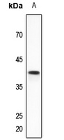 VEGFD Rabbit Polyclonal Antibody