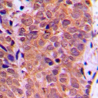 FOXO1 (Phospho-S319) Rabbit Polyclonal Antibody