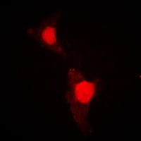 FOXO1 (Phospho-S319) Rabbit Polyclonal Antibody