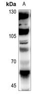 FLI1 Rabbit Polyclonal Antibody