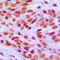 FLI1 Rabbit Polyclonal Antibody
