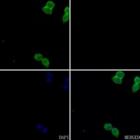 FR alpha Rabbit Polyclonal Antibody