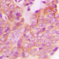 FRK Rabbit Polyclonal Antibody