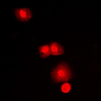 mTOR Rabbit Polyclonal Antibody