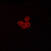 FSHR Rabbit Polyclonal Antibody