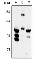 FYB Rabbit Polyclonal Antibody