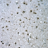 FYB Rabbit Polyclonal Antibody