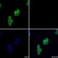 FYB Rabbit Polyclonal Antibody