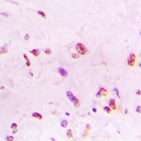 Ku70 Rabbit Polyclonal Antibody