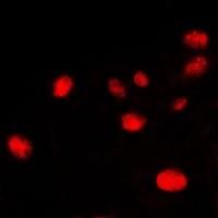 Ku70 Rabbit Polyclonal Antibody