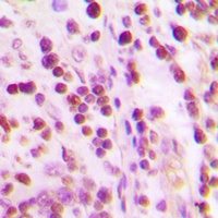 Ku70 Rabbit Polyclonal Antibody
