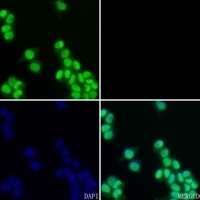 Ku70 Rabbit Polyclonal Antibody