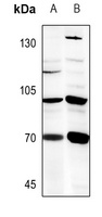 B4GALNT1 Rabbit Polyclonal Antibody