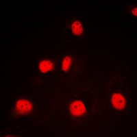 GATA1 Rabbit Polyclonal Antibody