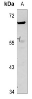 GDF9 Rabbit Polyclonal Antibody