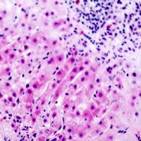 GDF9 Rabbit Polyclonal Antibody