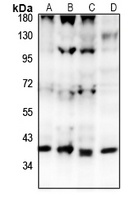 GPR15 Rabbit Polyclonal Antibody