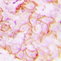 GPR20 Rabbit Polyclonal Antibody